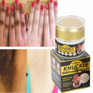 Best Whitening Cream Dark Knuckles Removal