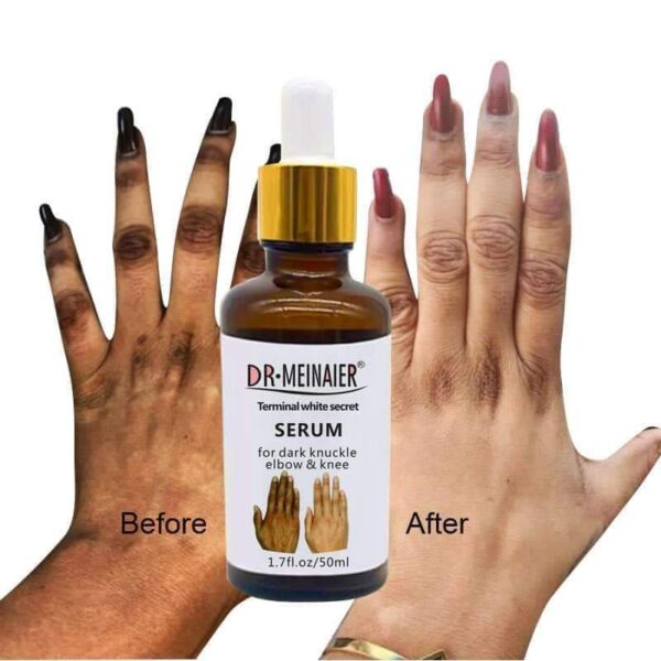 DR MEINAIER DARK KNUCKLE SERUM - Image 3