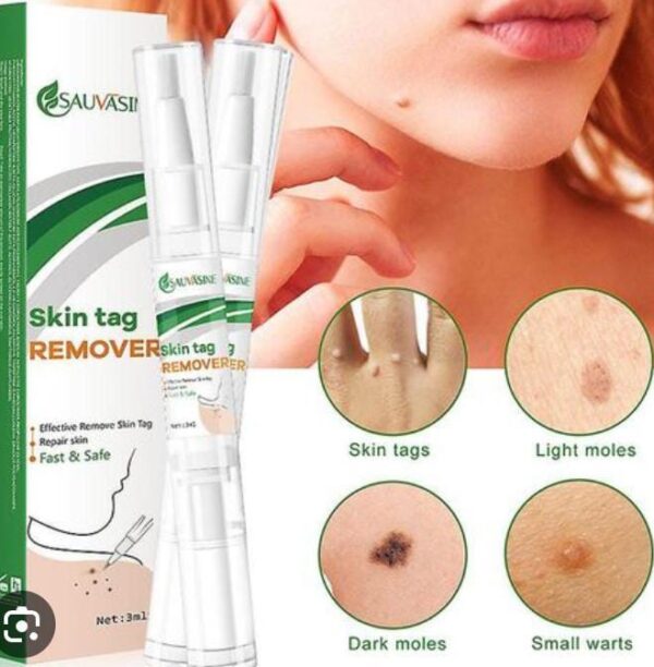 Skin Tag Remover Against Dark Moles Removal Genital Wart